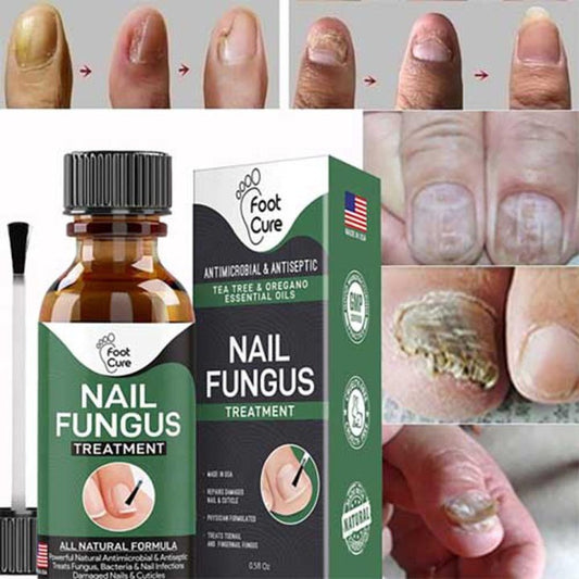 Fast Nail Fungal Treatments